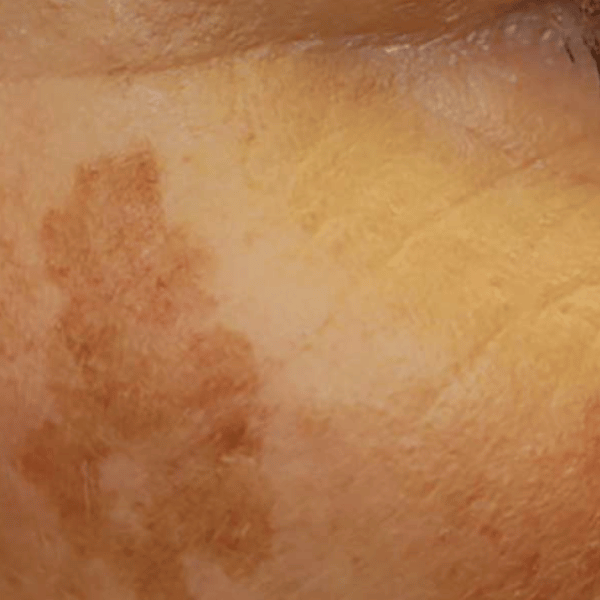 Sun Spots